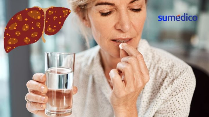 ¿Tomar aspirina en dosis bajas ayuda a las personas con enfermedad hepática?