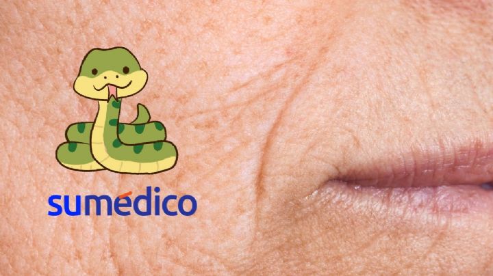 ¿Qué tanto ayuda el veneno de serpiente para eliminar arrugas?