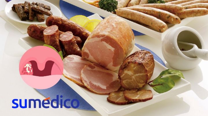 El tipo de alimentos que se relaciona con el cáncer de boca