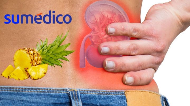 ¿Cuál es la mejor fruta para los riñones? Conoce los beneficios de la piña