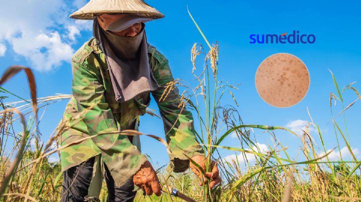 Los daños que causa trabajar bajo el sol, según la OMS