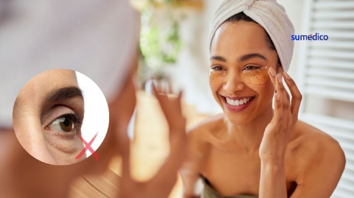 6 trucos para quitar ojeras y bolsas en los ojos de forma natural
