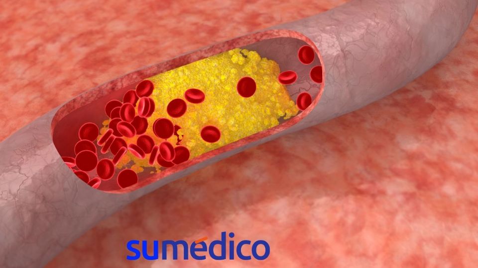 Descubre como reducir el colesterol