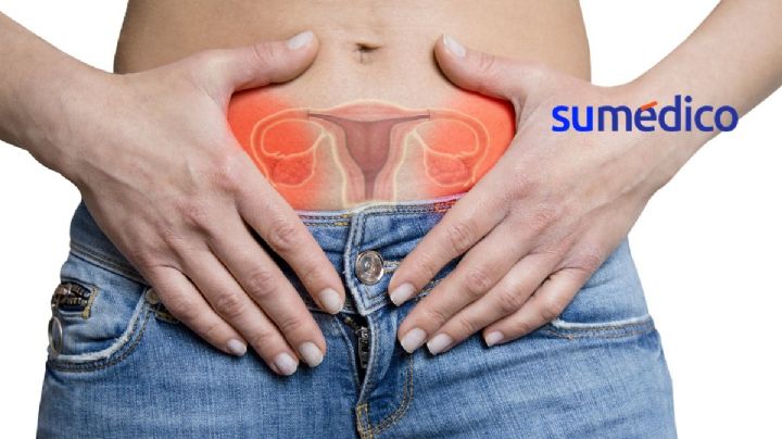 Este descubrimiento podría ayudar al tratamiento de fibromas uterinos