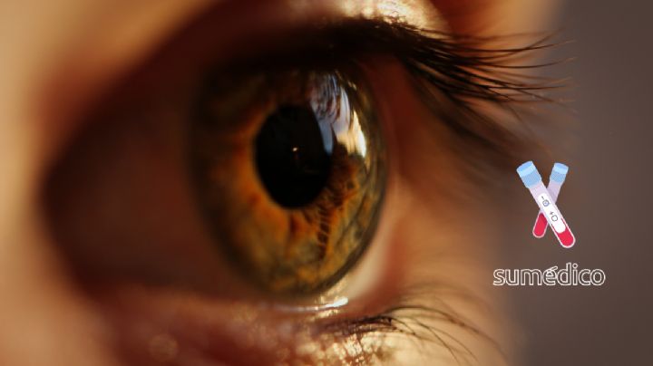 ¿Qué es la sífilis ocular y por qué causa alertas?