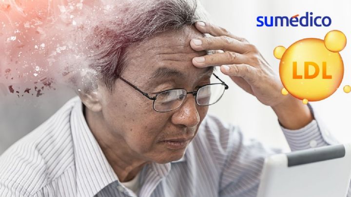 ¿Tener colesterol bueno alto puede causar demencia?