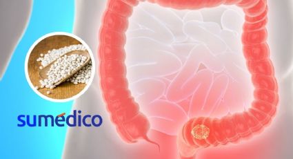 Estos son los beneficios de las alubias blancas en supervivientes de cáncer colorrectal