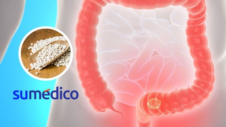 Así puedes mejorar tu salud intestinal con alubias blancas.