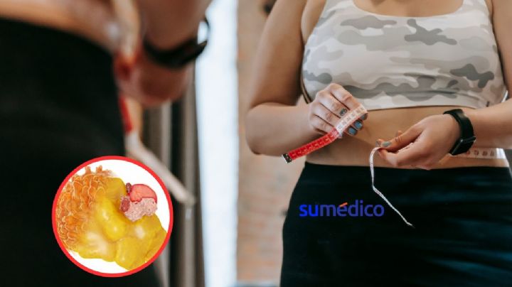 Conoce los alimentos que debes consumir para reducir la grasa visceral