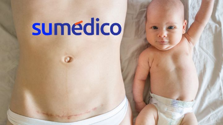 ¿Nacer por cesárea afecta tu rendimiento escolar?