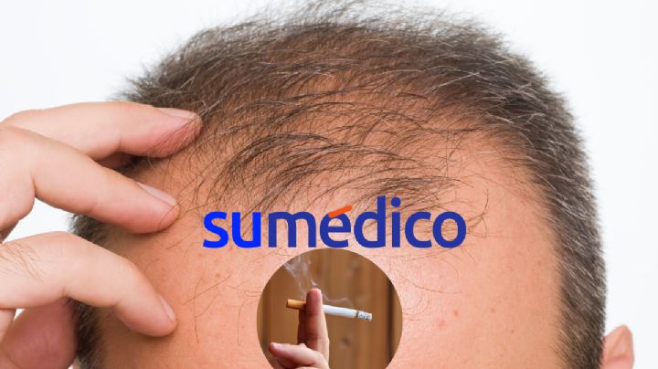 ¿Cómo afecta fumar para la pérdida de cabello?