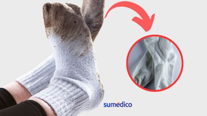 Trucos para tener calcetas blancas y relucientes