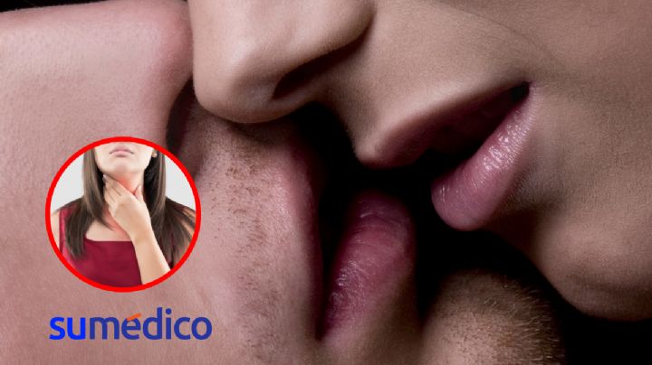 ¿Qué es la enfermedad del beso y cómo se contagia?