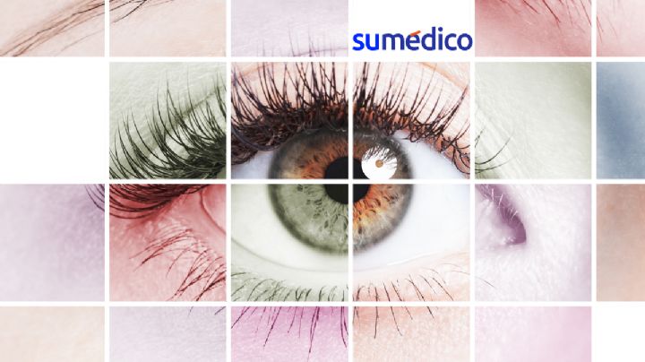 ¿Cuáles enfermedades están detrás de los ojos amarillos?