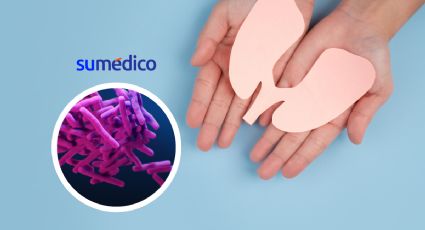 En América mueren cerca de 90 personas al día por tuberculosis ¿cómo prevenir?