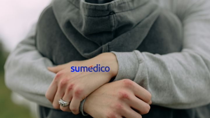 ¿Cómo actuar ante autolesiones en adolescentes?