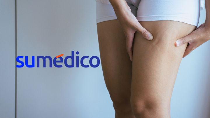 5 hábitos para reducir la celulitis del cuerpo