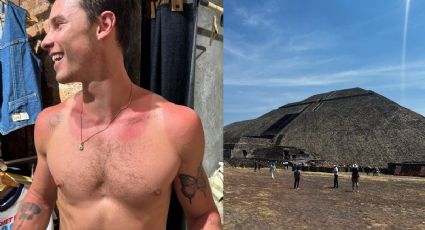 ¿Cómo aliviar quemaduras de sol como las que sufrió Shawn Mendes?