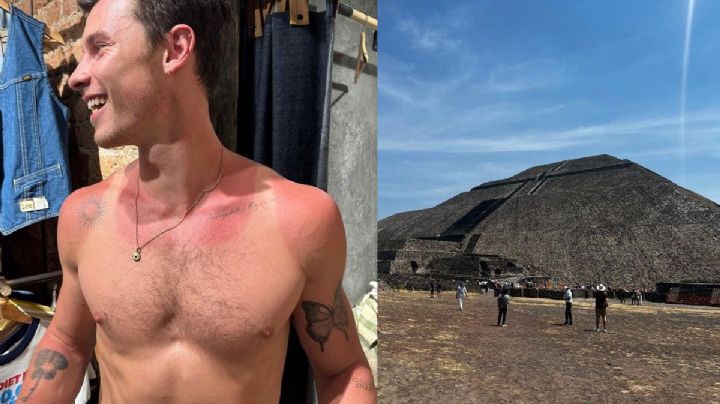 ¿Cómo aliviar quemaduras de sol como las que sufrió Shawn Mendes?