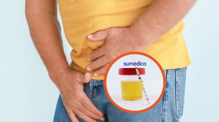 5 cambios en la orina que avisan sobre el cáncer de próstata
