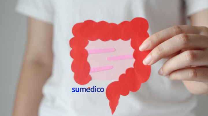 Nuevo fármaco previene efectos secundarios por quimioterapia en cáncer de colon y recto