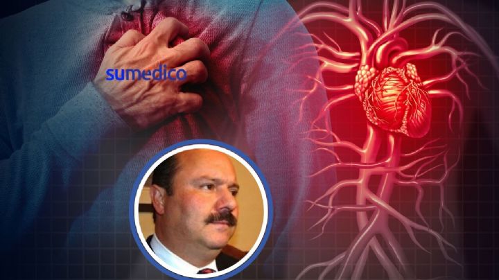 ¿Por qué ocurre un infarto como el que sufrió César Duarte y qué síntomas da?