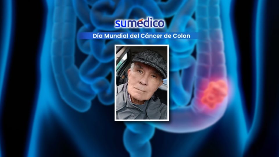 Cada 31 de marzo se conmemora el Día Mundial del Cáncer de Colon, una enfermedad que se puede detectar a tiempo.