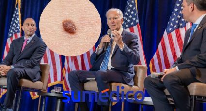 ¿Qué es un carcinoma por el que fue operado Joe Biden?