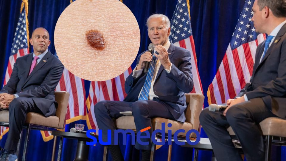 Joe Biden fue operado de un carcinoma