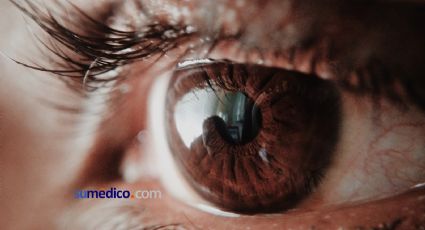 En México, el glaucoma es la primera causa de ceguera no reversible