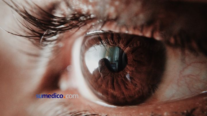 En México, el glaucoma es la primera causa de ceguera no reversible