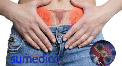 ¿Qué vínculo tiene el cáncer de ovario con la colonización bacteriana en el microbioma?