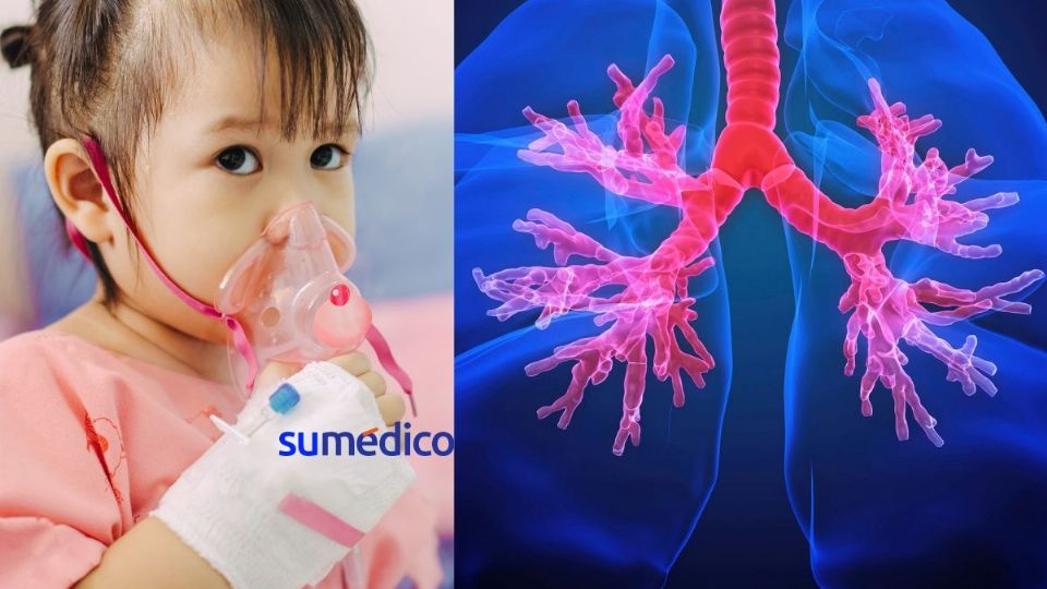 Las enfermedades respiratorias crónicas representan un problema de salud pública, con unos 3,9 millones de muertes mundiales.