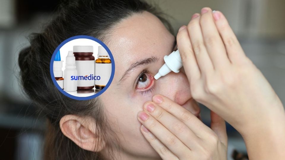 Conoce los supuestos medicamentos que Cofepris alerta sobre el uso para la irritación de ojos