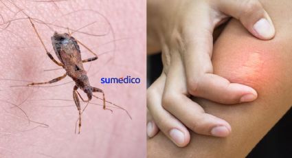 Conoce la vinchuca, insecto transmisor de la enfermedad de Chagas