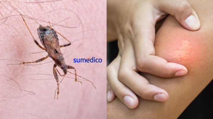 Conoce la vinchuca, insecto transmisor de la enfermedad de Chagas