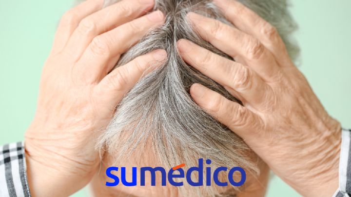 Causas que aceleran la aparición de las canas y cómo prevenirlas