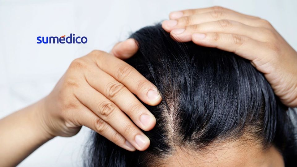 Puedes reducir la caída de tu cabello siguiendo estos consejos