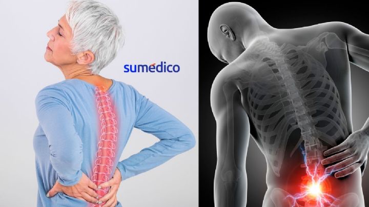 3 ejercicios para evitar el dolor de espalda