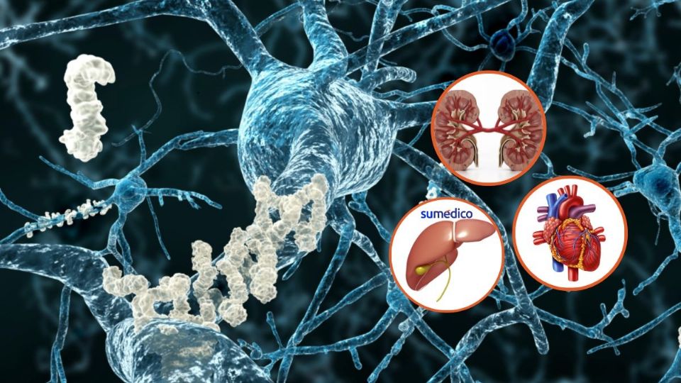 ¿Conoces esta enfermedad? Así es como la amiloidosis puede afectar a la salud.