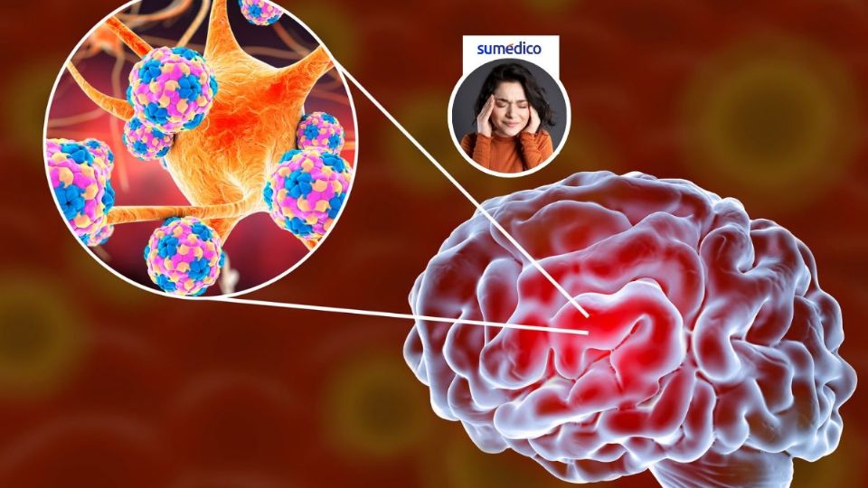 Hoy es el Día Mundial de la Meningitis. ¿Qué tanto conoces sobre esta enfermedad?