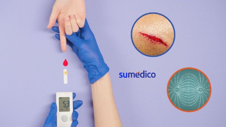 ¿Es posible acelerar la curación de heridas de pacientes diabéticos con electricidad? La ciencia lo explica