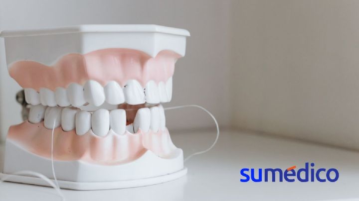 ¿Por qué es importante reponer un diente que se te ha caído?