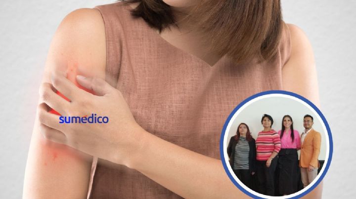 La dermatitis atópica provoca que 9 de cada 10 pacientes no vacacionen