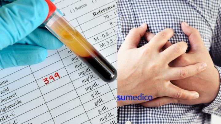 4 de cada 10 mexicanos tienen colesterol alto; aquí te decimos cómo evitarlo