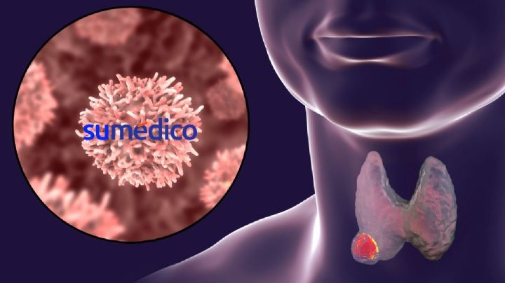 Expertos alertan aumento de cáncer de garganta, ¿Qué lo causa?