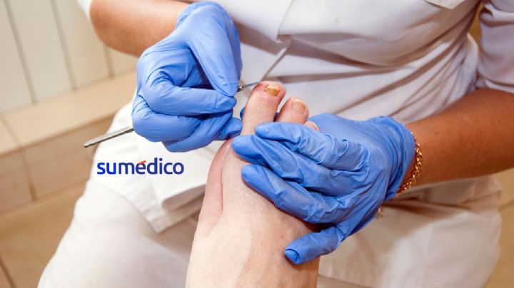 Tips para cuidar los pies de personas con diabetes