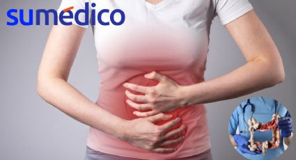 ¿Qué nuevos síntomas se asocian al cáncer de colon?