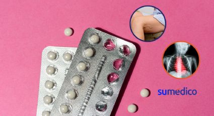 Pastillas anticonceptivas podrían ser más efectivas incluso con menos hormonas: estudio