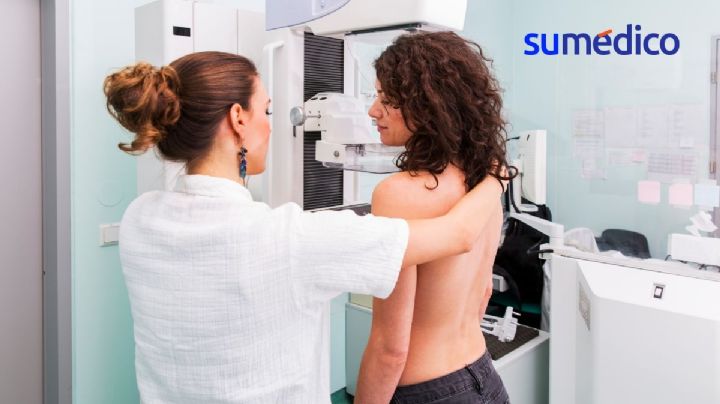 ¿A qué edad debes hacerte una mastografía? Experto de Harvard responde